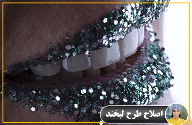 اصلاح طرح لبخند