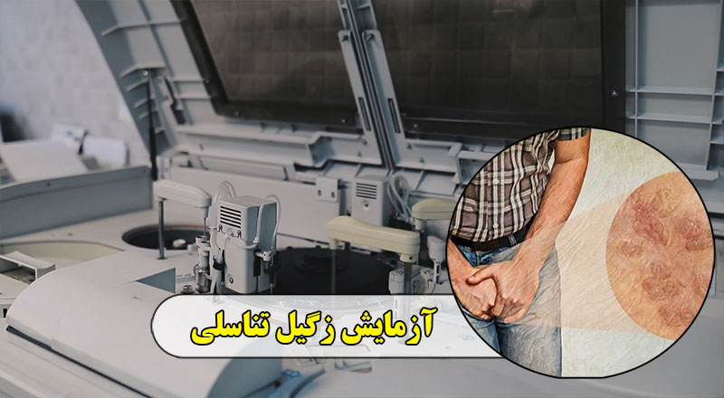 آزمایش زگیل تناسلی